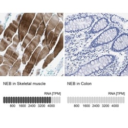 Nebulin Antibody, Novus Biologicals:Antibodies:Primary Antibodies